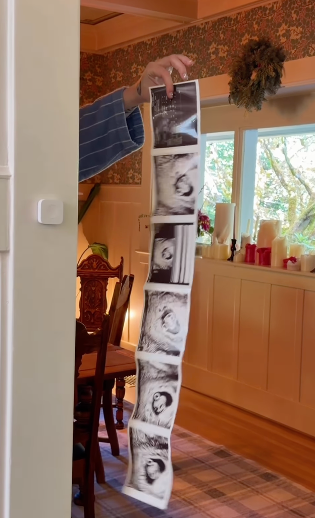 The montage ended with Ireland holding a strip of sonogram images