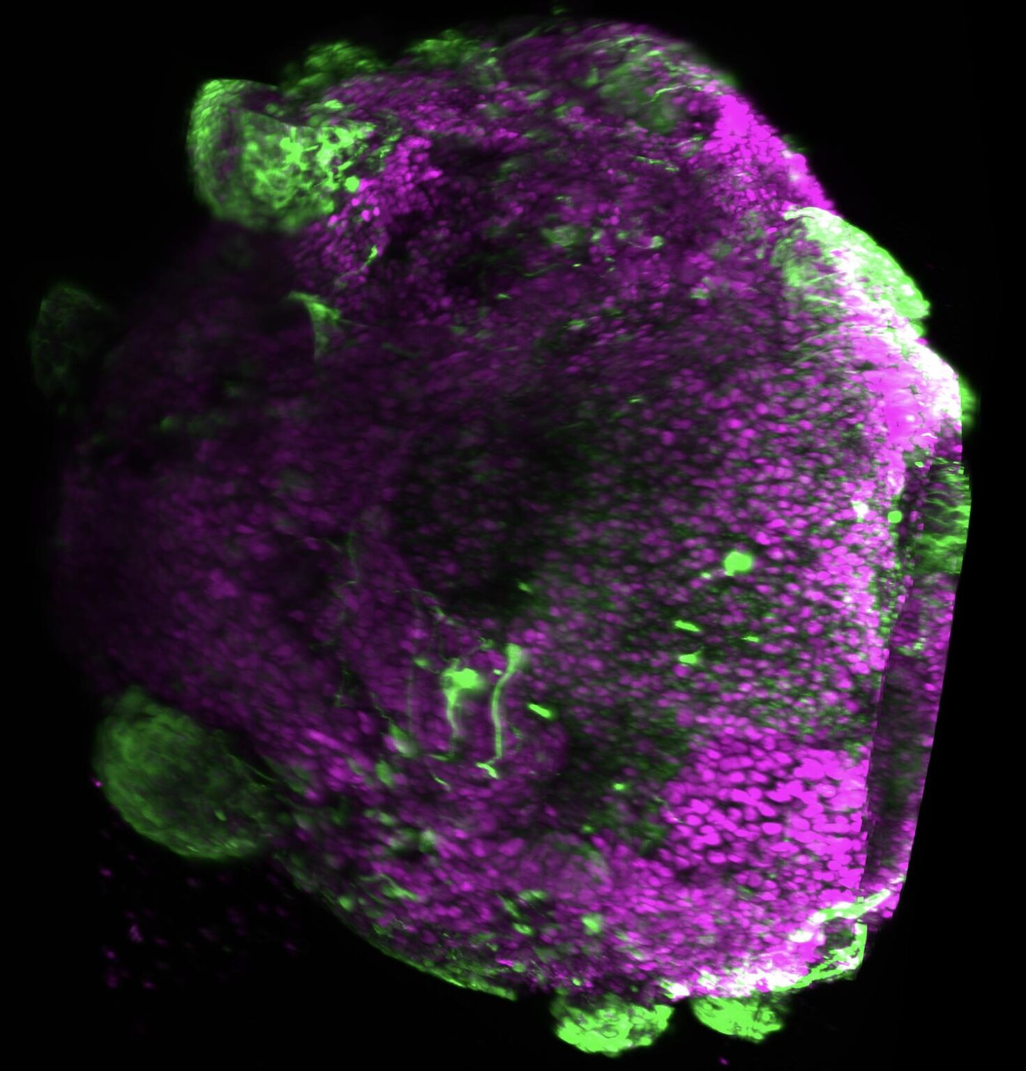 Researchers are testing whether opposing growth-factor beads can give human cortical brain organoids real regional identity, adapting 1990s embryology to iPSC 3D culture