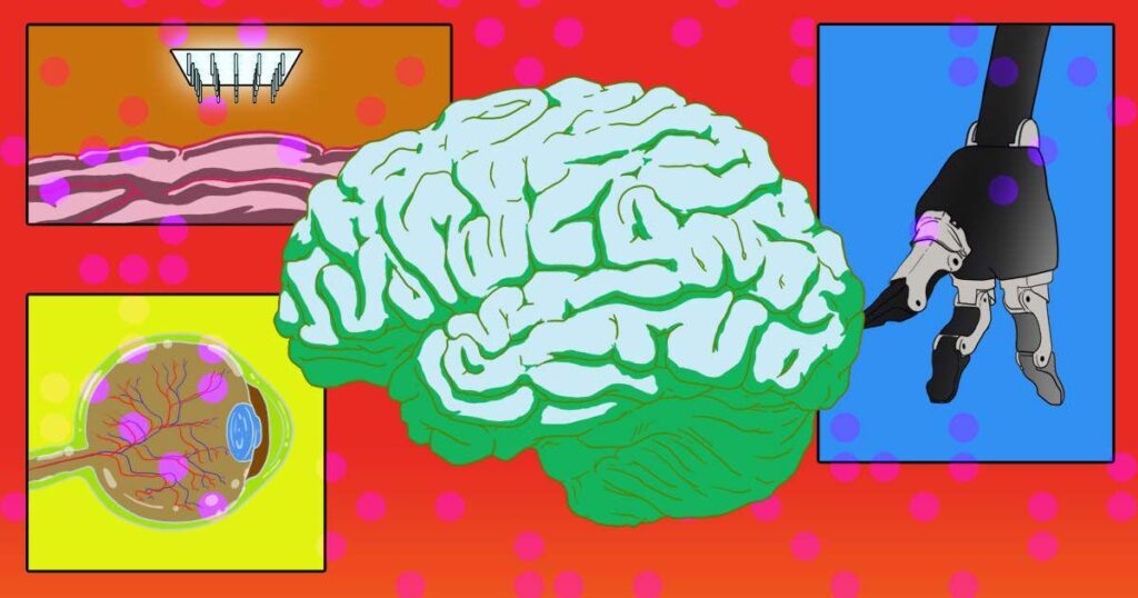 Why Brain Implants Are More Than a Sci-Fi Fantasy
