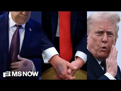Why aren’t Democrats talking about Trump’s health?