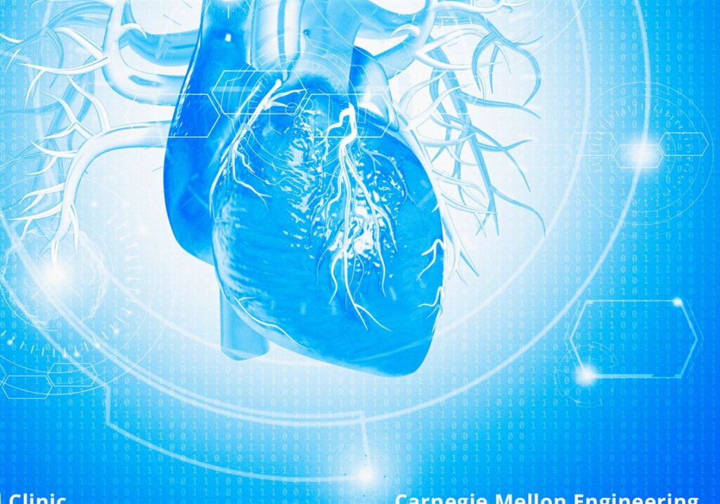 Artificial intelligence is helping treat the heart