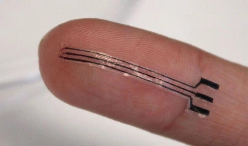 A 3D-Printed Hydrogel Implant Could Treat High Blood Pressure Without Medication - 3Dnatives