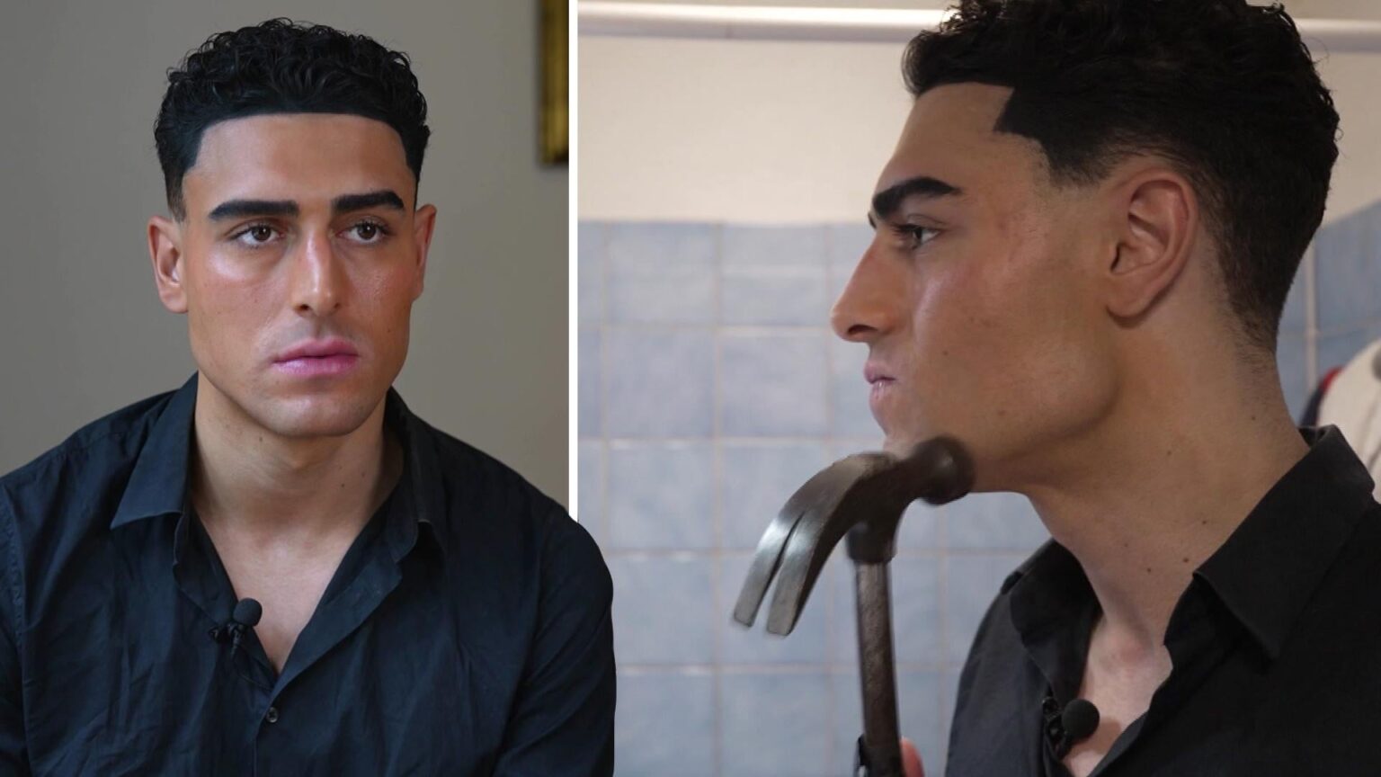 25-year-old Gabriel hits himself in the face with a hammer - to look better