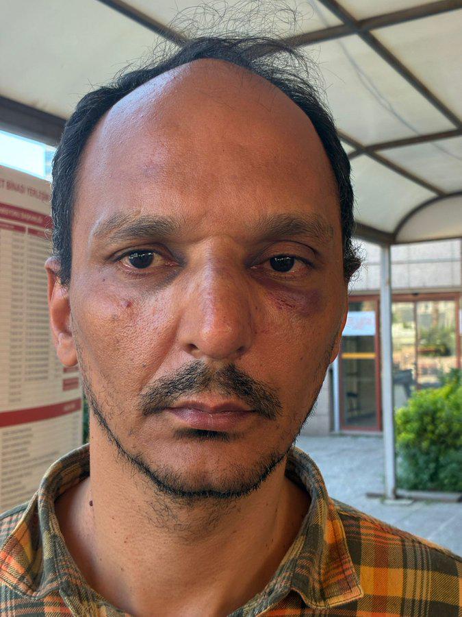 The citizen who climbed on top of the tom was beaten and detained. Citizen was arrested