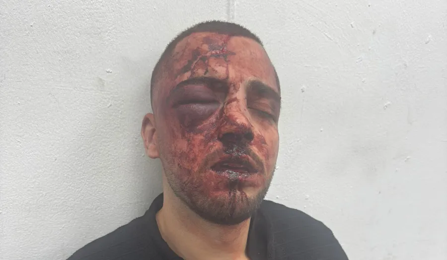 Police said to beat, break nose, arrest a state prosecutor, who is Arab, over noise complaint