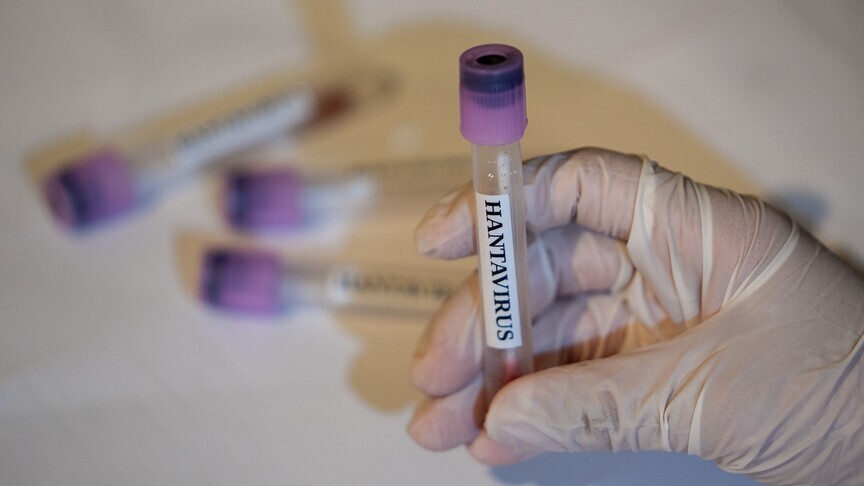 France says all hantavirus contacts asymptomatic, 4 children test negative logo