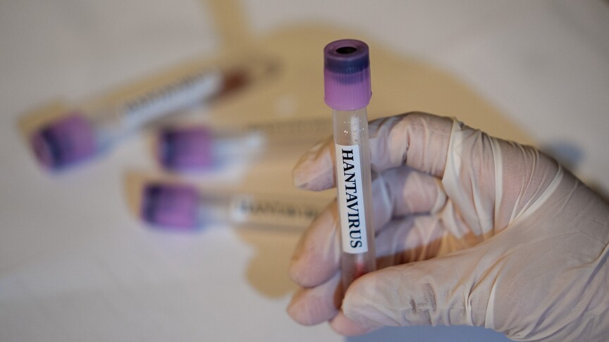 EU accelerates research into hantavirus vaccines logo