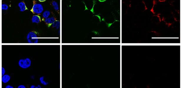 Scientists use ultrasound to destroy influenza A and COVID-19 viruses without damaging human cells. The phenomenon, known as acoustic resonance, causes structural changes in viral particles until they rupture and become inactivated. It paves the way for new treatments against other viral infections.