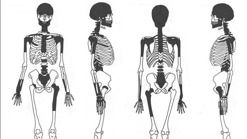 Iron Age woman likely had her brains scooped out before burial, study suggests