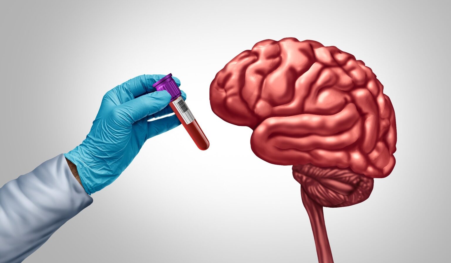 Blood metabolites reveal lifestyle links to brain health before dementia Review: Beyond estrobolome 1.0: unraveling endocrine-microbiome axis as a driver and therapeutic target in hormone-driven cancers. Image Credit: Lightspring / Shutterstock