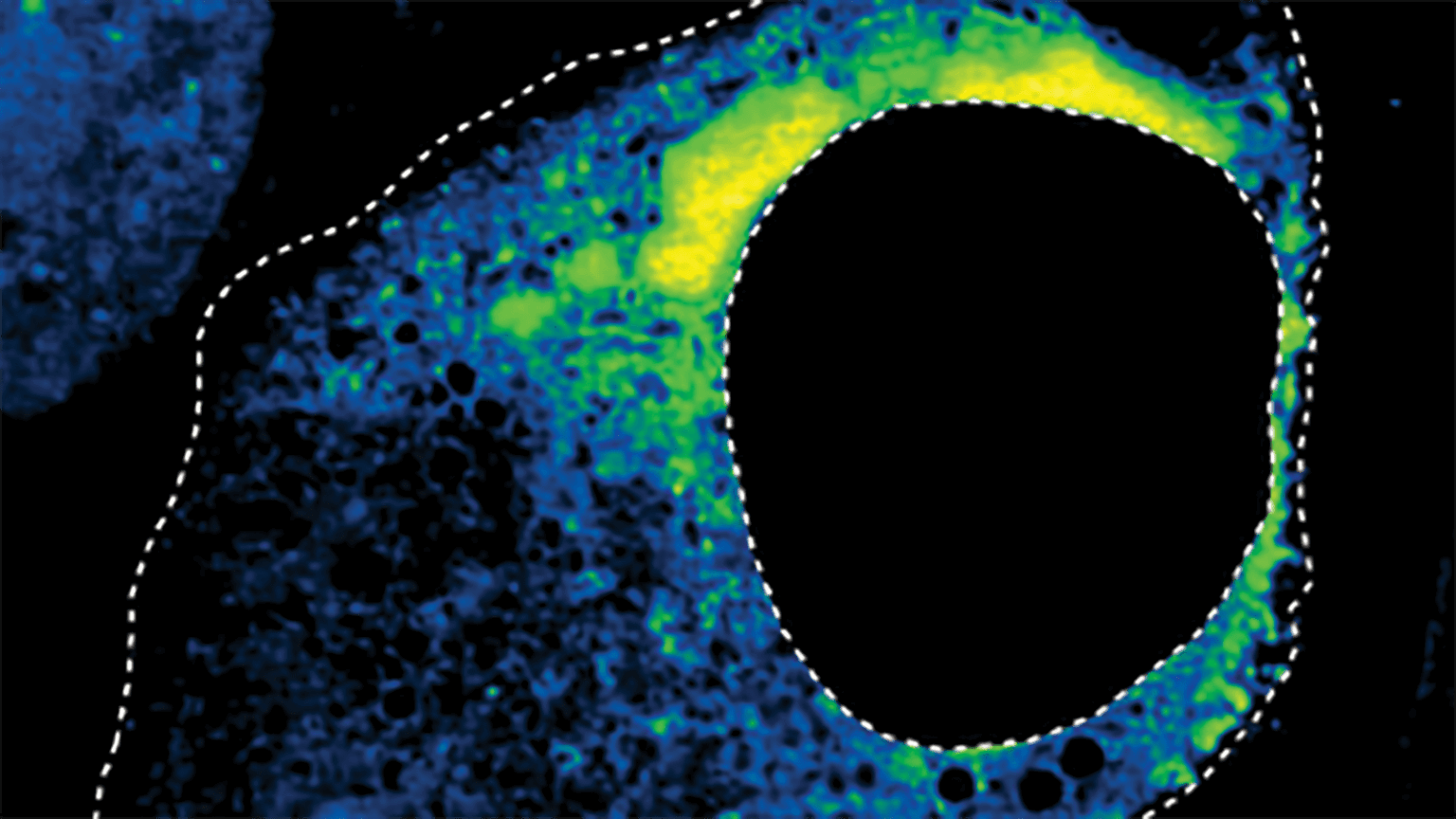 Researchers have harnessed AI to study how drugs shape biomolecular condensates, tiny blob-like structures within cells that drive gene-regulation processes and are linked to diseases such as Alzheimer's and cancer [Cell]