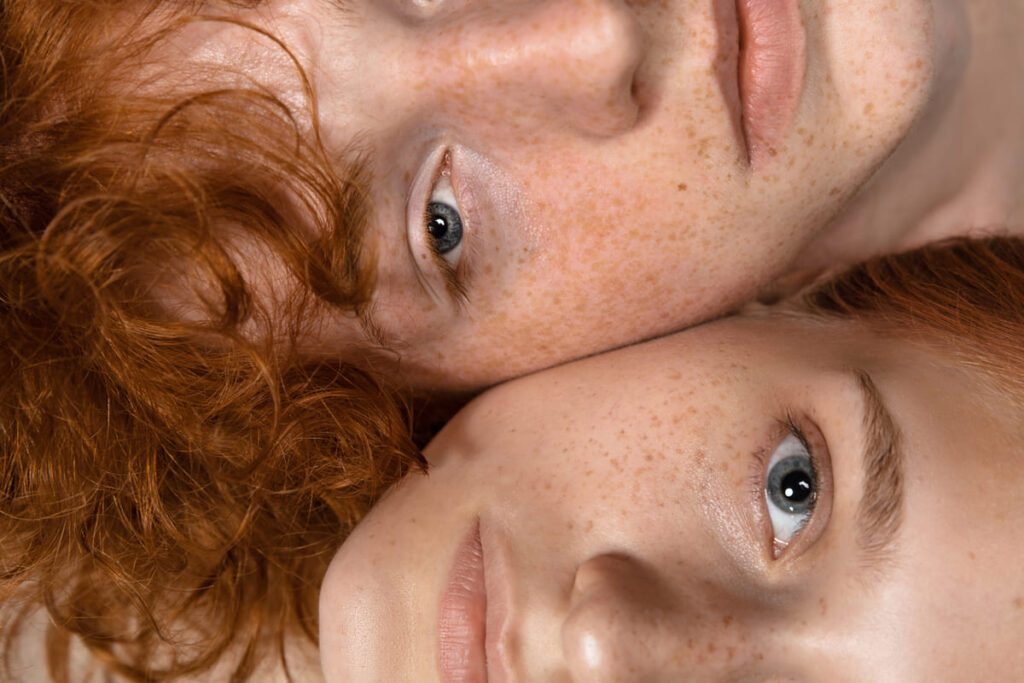 Not all redheads have freckles: scientists reveal surprising genetic truth Not all redheads have freckles: scientists reveal surprising genetic truth