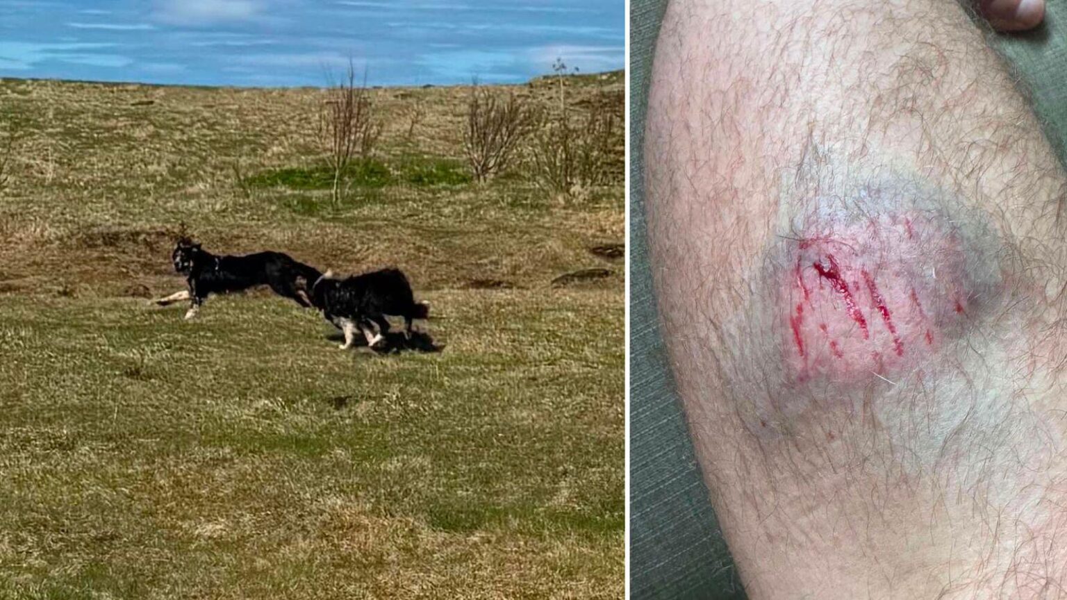 Two in emergency department after attack by loose dogs