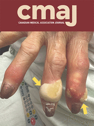 Differences in admission to trauma centres by sex among adults with traumatic brain injury: a population-based cohort study
