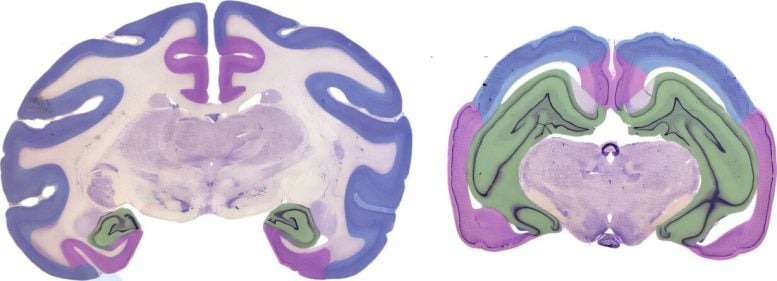 Squirrel Monkey and Armadillo Brain Cross Sections