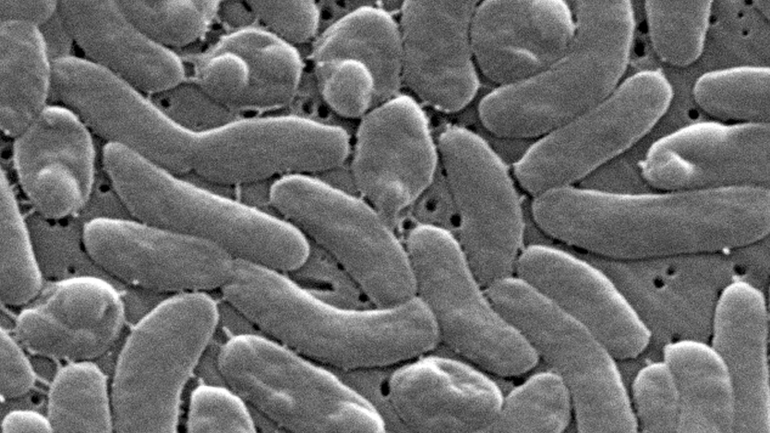 Health officials urge caution for Gulf Coast beachgoers during surge of deadly bacterial infections Health officials urge caution for Gulf Coast beachgoers during surge of deadly bacterial infections